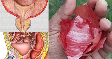 El Poder de la cáscara de cebolla con la Próstata y la Vejiga